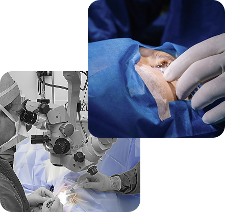Surgeons performing an eye operation, shown in two images: one of a doctor using an operating microscope, and a close-up of gloved hands working on a patient's eye during surgery.